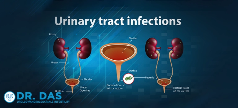 Urinary tract infection